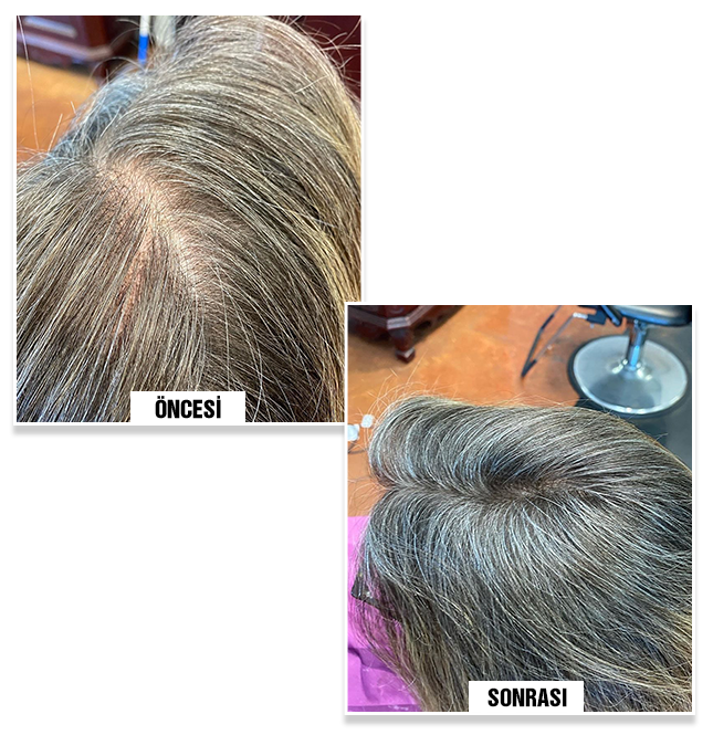  before and after using Bunee