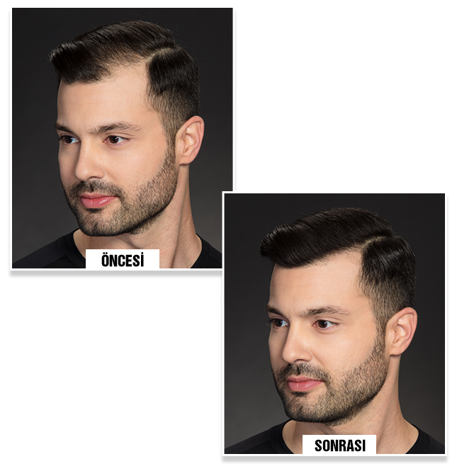 Adam K. before and after using Bunee