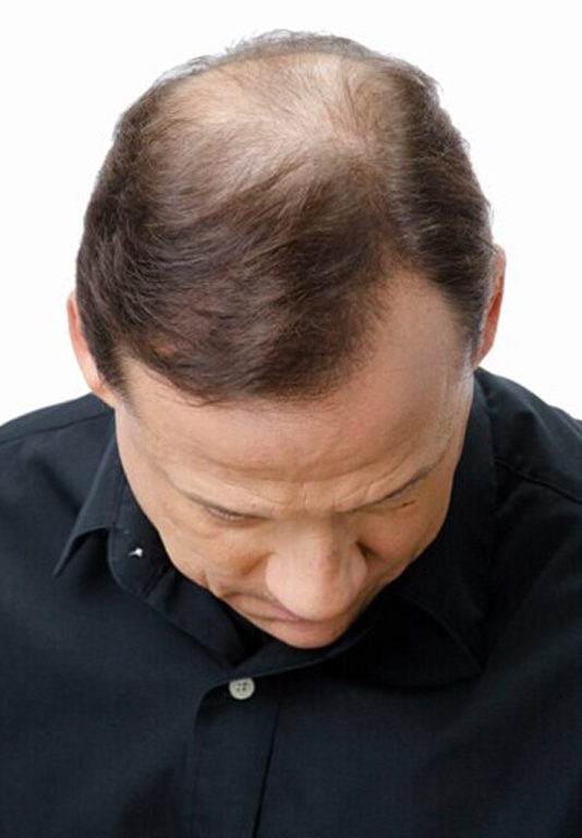 Girl before using Bunee